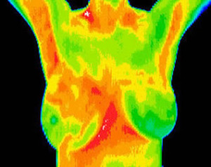 breasts thermography